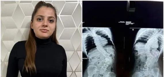 Foto Alexandra are nevoie de sprijinul nostru. 37.400 de euro este preţul unei vieţi normale pentru tânăra de doar 15 ani