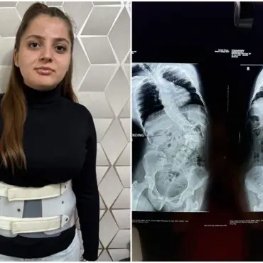 Foto Alexandra are nevoie de sprijinul nostru. 37.400 de euro este preţul unei vieţi normale pentru tânăra de doar 15 ani