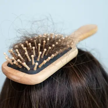 Foto Cauzele comune ale căderii părului și ce poți face 