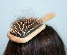 Foto Cauzele comune ale căderii părului și ce poți face 