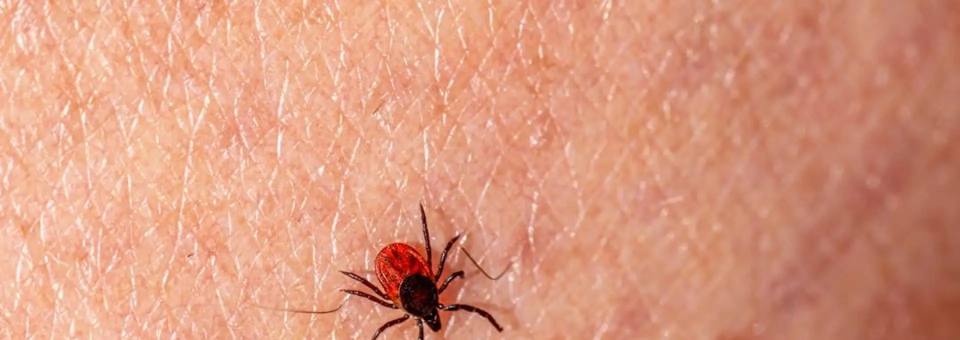 Foto 13 persoane au ajuns la spitalele din Slatina şi Caracal cu înțepături de căpușe