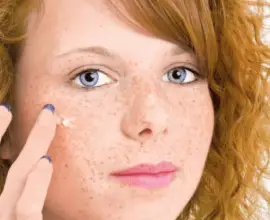 Foto Pistruii - remedii împotriva petelor de pe piele