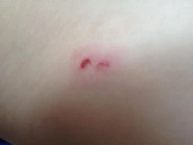 Foto Anchetă la o grădiniţă din Olt după ce mai mulţi copii au ajuns acasă cu vânătăi şi muşcături