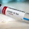 Imagine Medic infecţionist: „Variantele noi virale ale SARS-CoV-2 nu vor fi mai agresive, dar se vor transmite ușor”