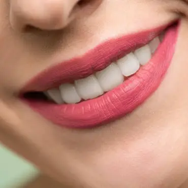 Foto Sfaturi pentru întreținerea dinților după proceduri estetice dentare
