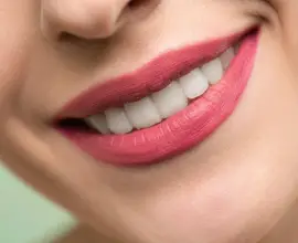 Foto Sfaturi pentru întreținerea dinților după proceduri estetice dentare